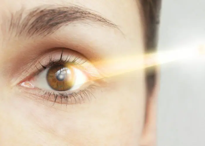 Laserstrahl Augenlasern Laserstrahl ins Auge beim Augenlasern